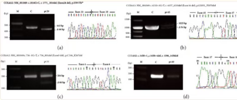 图 4:RT–PCR 验证基因突变对基因转录表达的影响 图 4:RT–PCR 验证基因突变对基因转录表达的影响